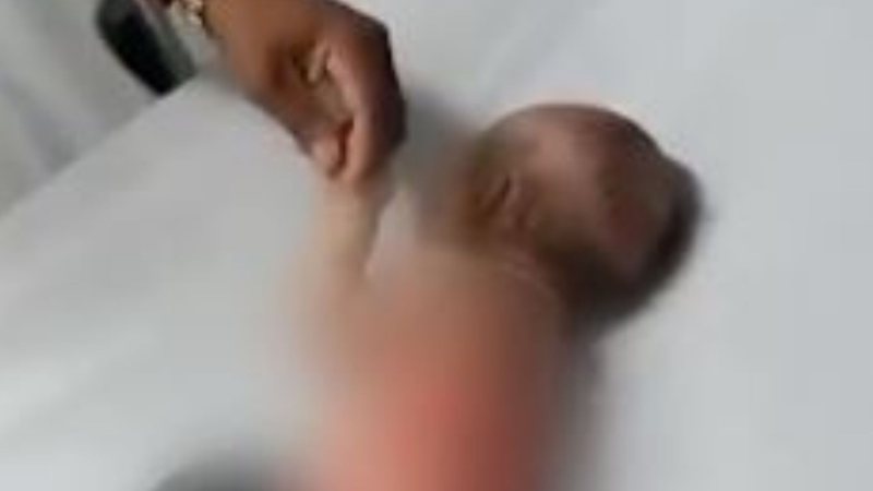 Mulher é presa suspeia de queimar filha de 2 meses e namorado em Salvador