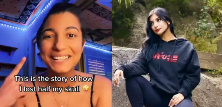 Mulher tem parte do crânio removida após ter severas crises de sinusite