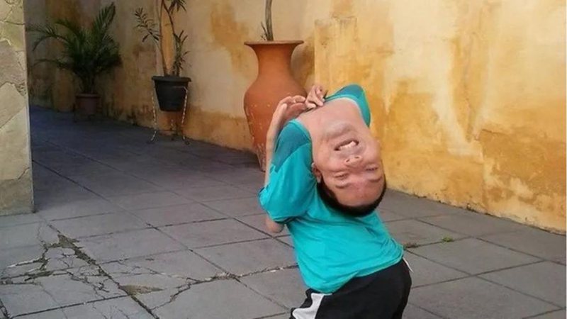 BRASILEIRO COM CABEÇA INVERTIDA PARTICIPA DE ESTUDO REALIZADO POR CIENTISTAS