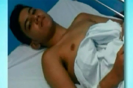 Garoto de 14 anos contrai síndrome rara após vacina contra febre amarela na Bahia