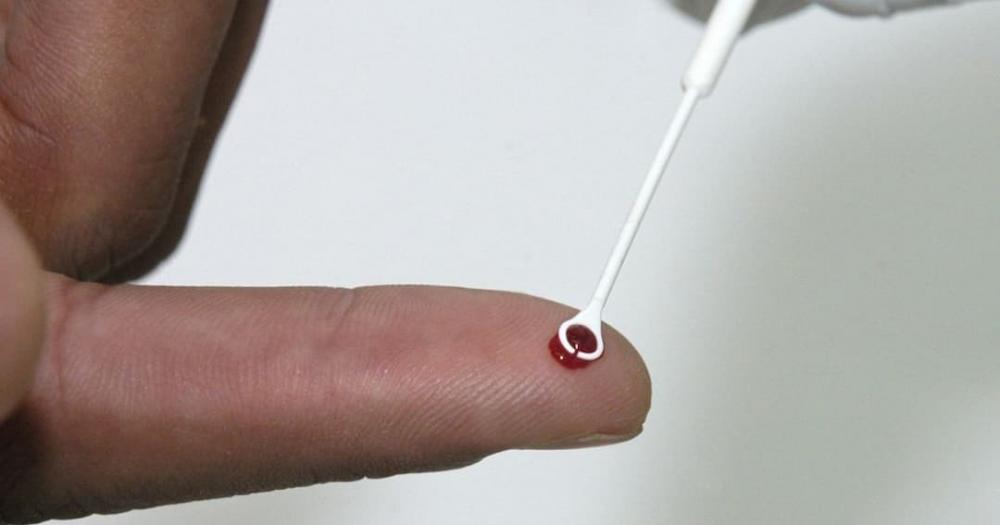 Com longevidade de pacientes com HIV, governo atualiza tratamento