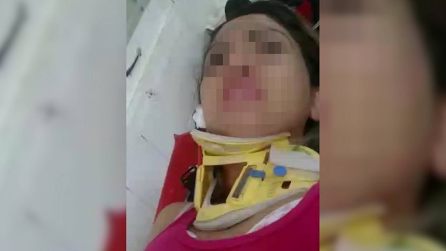 Jovem pula do 4º andar no DF para fugir do marido que a confundiu com atriz pornô após ver filme no computador