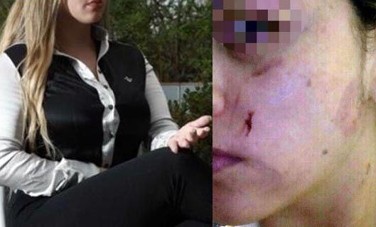 Juíza é agredida em orgia com três vereadores e caso vai parar na delegacia