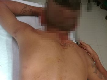 Jovem de 20 anos sofre tentativa de homicídio durante festa em Jeremoabo- BA
