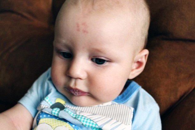 Bebê impressiona ao nascer com número 12 estampado na testa