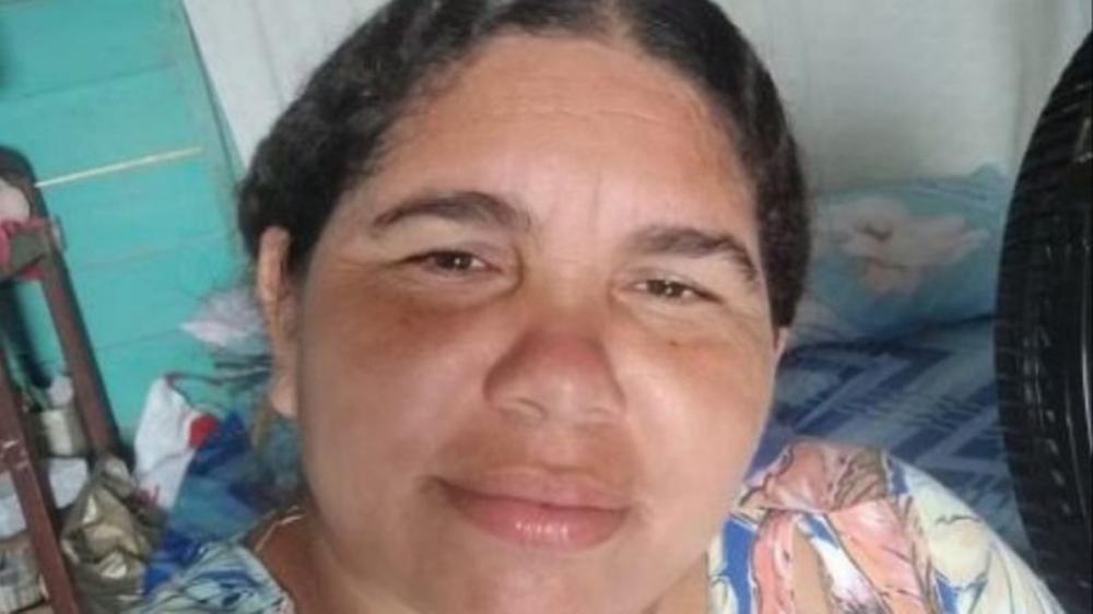Mulher tem útero retirado por engano em hospital no Pará durante cirurgia programada para a clavícula