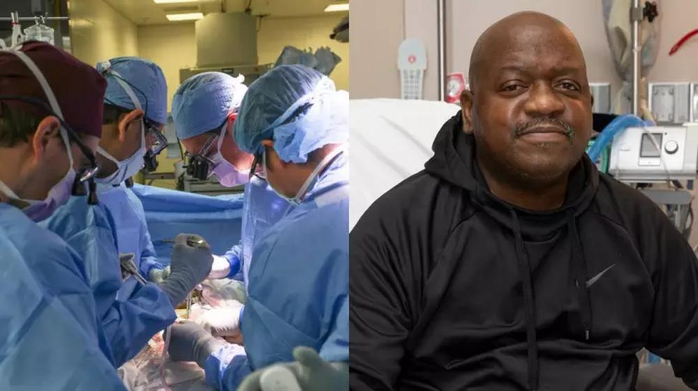 Paciente que recebeu primeiro transplante de rim suíno morre após dois meses