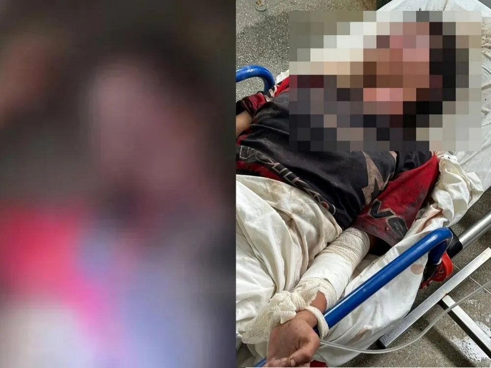 Adolescente fica com rosto desfigurado após tortura e abuso em Alagoas; Acusado é preso