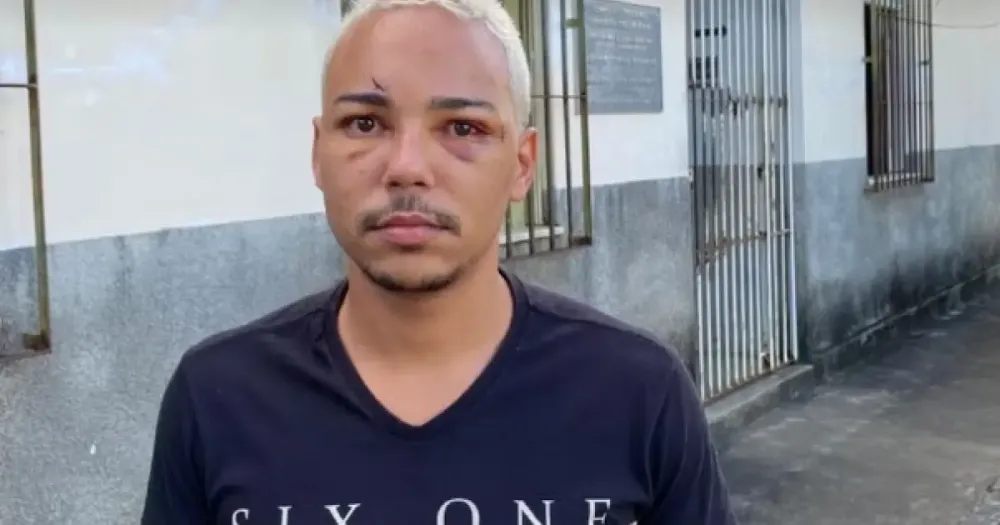 Participante de evento junino no Sudoeste baiano relata agressão e falta de socorro em festa