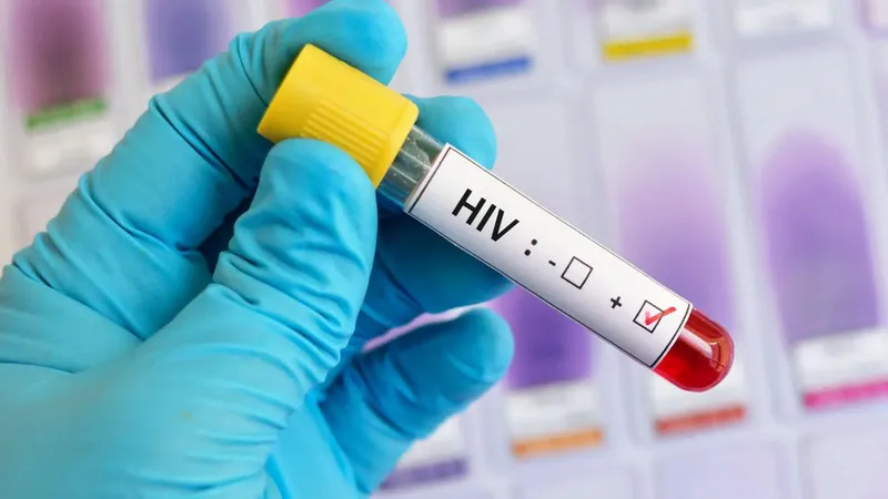 Nova variante do HIV é identificada na Bahia e em outros dois estados