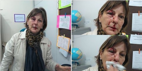 Após agressão covarde de aluno, professora faz desabafo emocionante