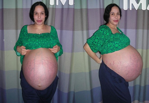 Lembra da mulher que teve 8 bebês? Veja como ela e eles estão hoje, 8 anos depois