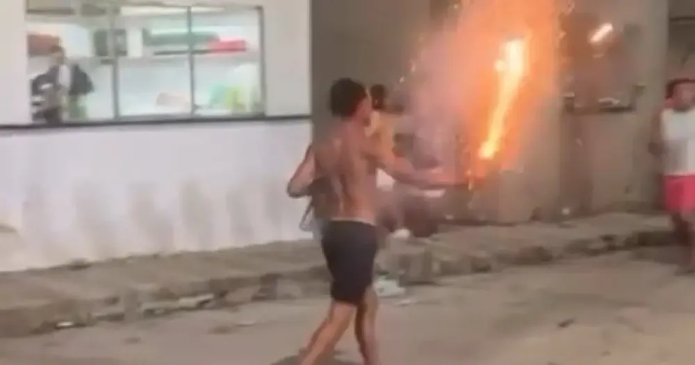 Jovem tem dedo decepado após espada de fogo explodir