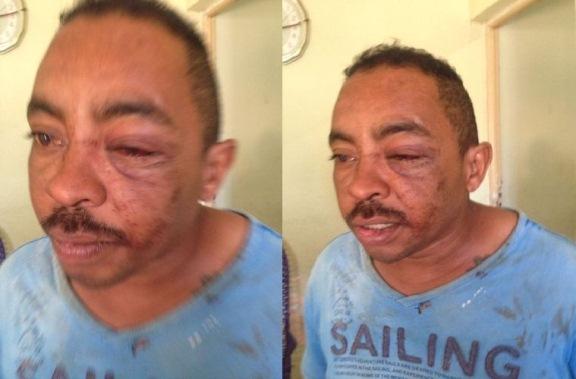 Mulher dá surra no ex-marido após ter botijão de gás furtado por ele