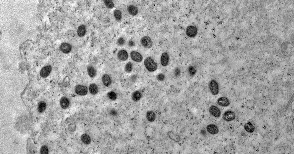Mpox não é motivo de alerta, diz Ministério da Saúde após 140 casos no Brasil em 2026
