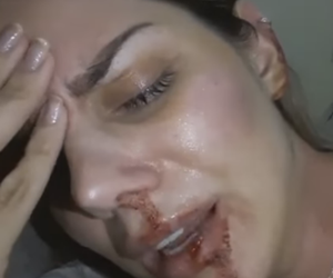 Modelo faz vídeo para denunciar agressões do marido, assista