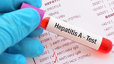 AUTORIDADES ALERTAM PARA SURTO DE HEPATITE A; VEJA COMO SE PREVENIR