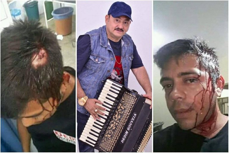 REI DO XOTE, DEDIM GOUVEIA É ACUSADO DE AGREDIR SANFONEIRO DA BANDA - FOTOS