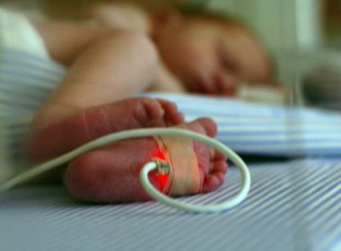 Para Unicef, é possível evitar 80% das mortes de crianças