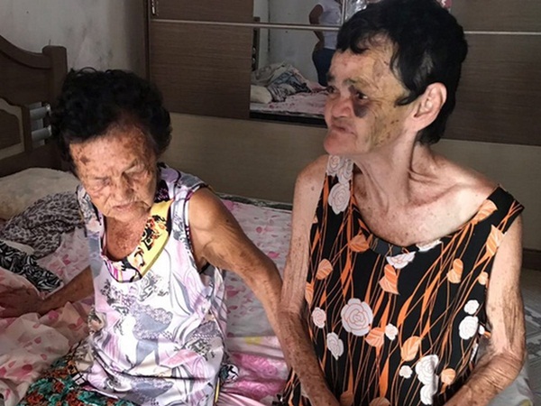 Sergipe: Idosa de 81 anos morre após ser espancada pela neta