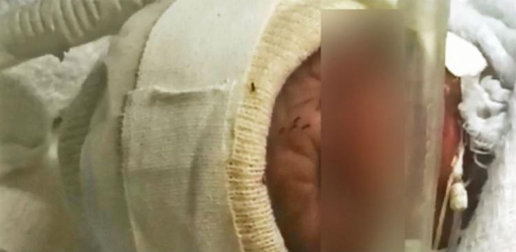 Formigas andam sobre rosto de bebê em maternidade de Minas Gerais