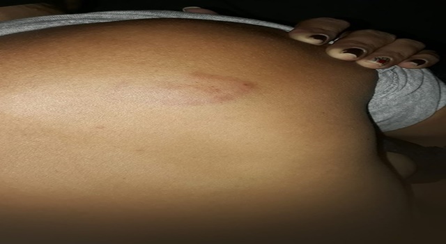  Mulher sofre tentativa de estupro em Uauá, Bahia