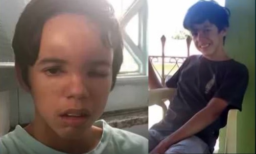 Mistério: Adolescente baiano fica com rosto deformado após forte dor de cabeça