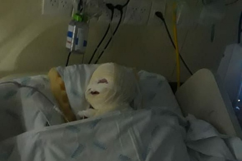 Bebê sofre queimadura no rosto dentro de sala de cirurgia após explosão de equipamento