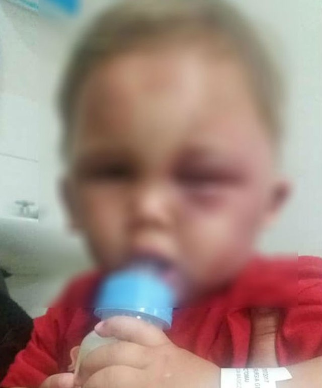 Padrasto é preso suspeito de agredir menino de um ano