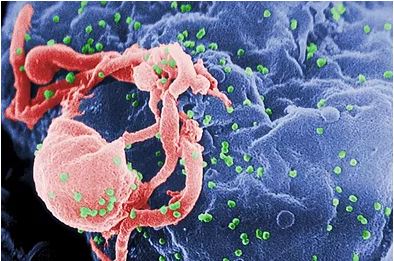 VÍRUS DA AIDS: VACINA É APLICADA COM SUCESSO EM MACACOS E PODERÁ SER TESTADA EM HUMANOS