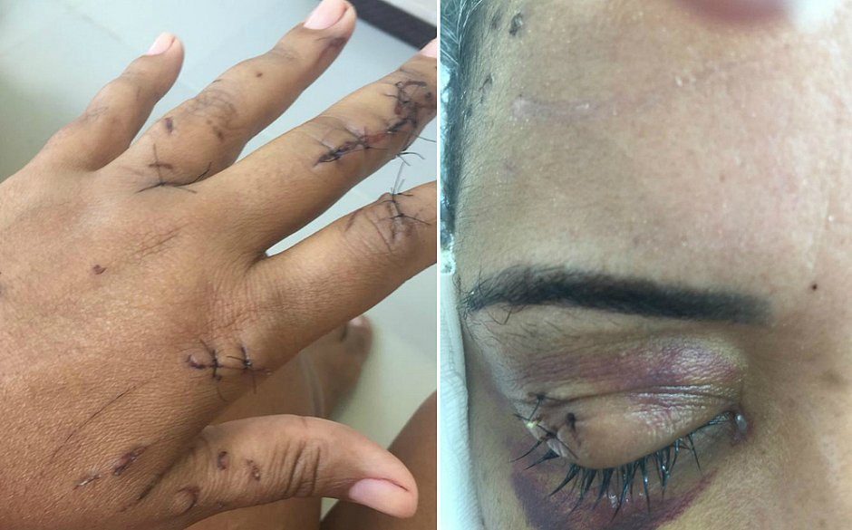 Leia depoimento de fisioterapeuta que levou 69 facadas na íntegra