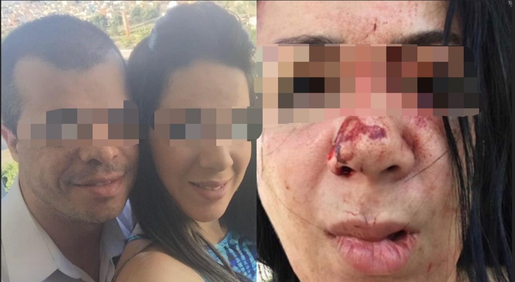 Mulher denuncia que marido pastor lhe espancou na frente dos filhos e fugiu