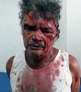 Idoso esfaqueia adolescente e é espancado por populares
