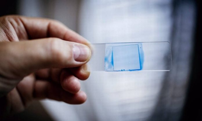 Fungo fatal que se espalha por hospitais pelo mundo pode chegar ao Brasil