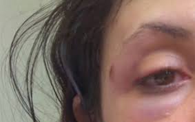 Indenização por danos morais a vítimas de violência doméstica pode virar lei