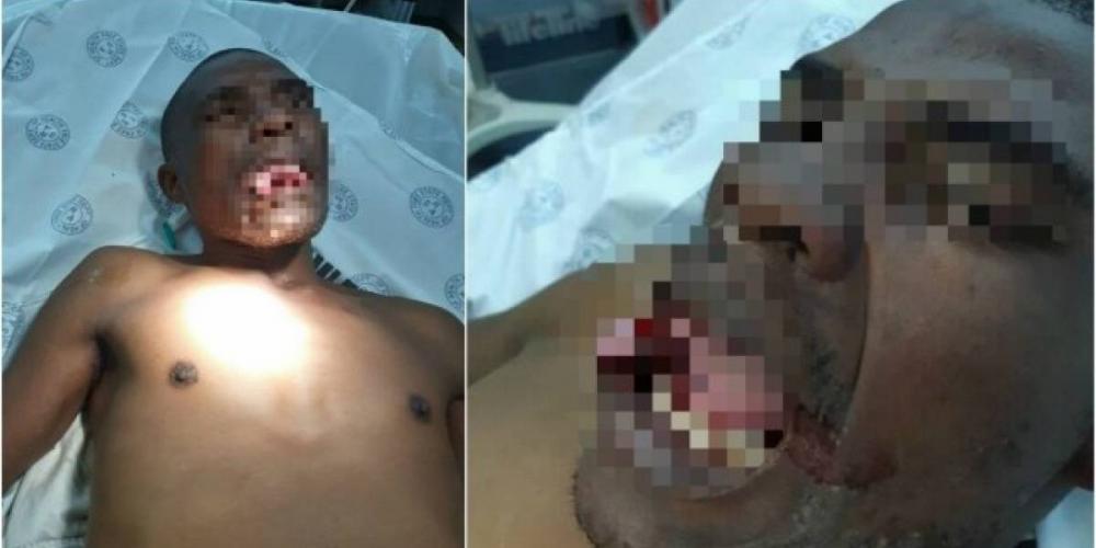 Médica arranca parte da língua de homem que tentou estuprá-la durante consulta