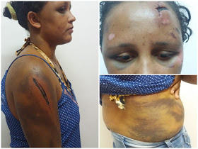 Mulher é resgatada, após ser torturada e mantida em carcere privado na zona rural de Petrolândia