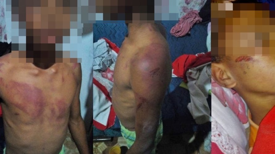 Criança de 11 anos é espancada pelo pai em Santo Amaro