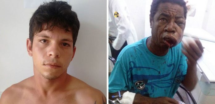Serrinha: Homem é espancado por jovem após ser acusado de envenenar gato