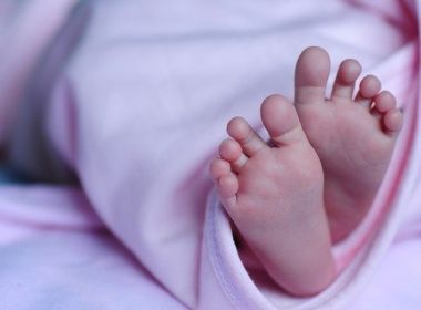 Bebê nasce sem rosto e parte do crânio e gera escândalo por negligência médica; entenda