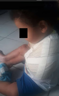 DESCASO: CRIANÇA DE 1 ANO E 3 MESES AGUARDA VAGA DE REGULAÇÃO EM CASA COM FRATURA NA CLAVÍCULA