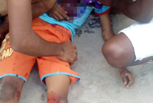 MENINO ATINGE VIZINHO DE 8 ANOS COM TIRO ACIDENTAL DE ESPINGARDA EM VALENTE-BA