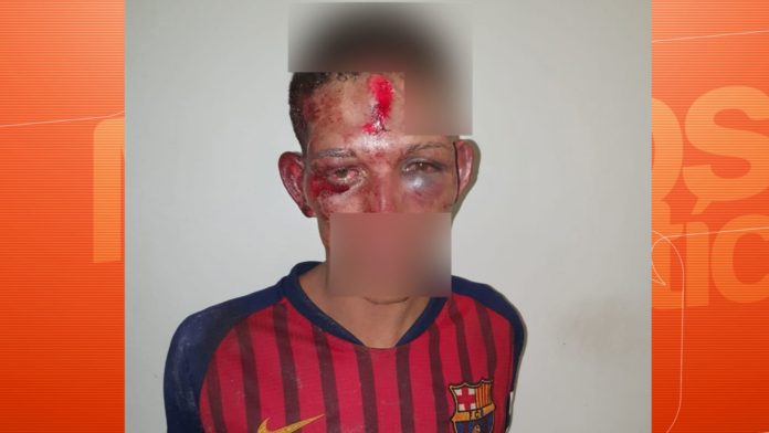 Homem entra em luta corporal com policial e termina com a cara quebrada em Valéria