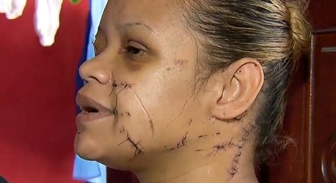 Mulher é atacada com golpes de faca por dono da casa após barulho 