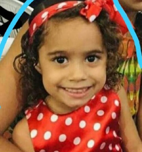 Criança atacada por cão da raça pitbull em Paulo Afonso morre após 13 dias internada