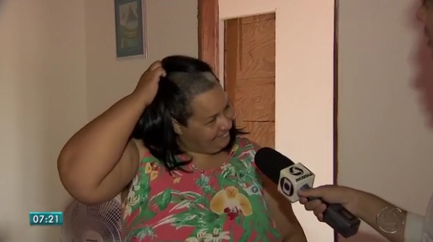 Professora fica careca logo após fazer “relaxamento” em salão