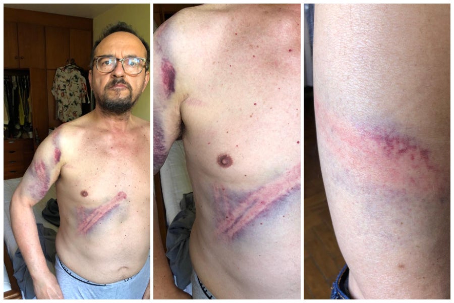 “Quase fui assassinado”: professor de 64 anos foi espancado por PMs na Alesp