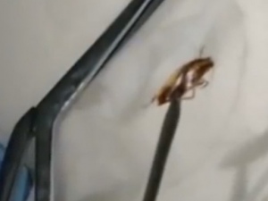 Chocante: Médico retira barata viva de dentro do crânio de paciente; veja vídeo!