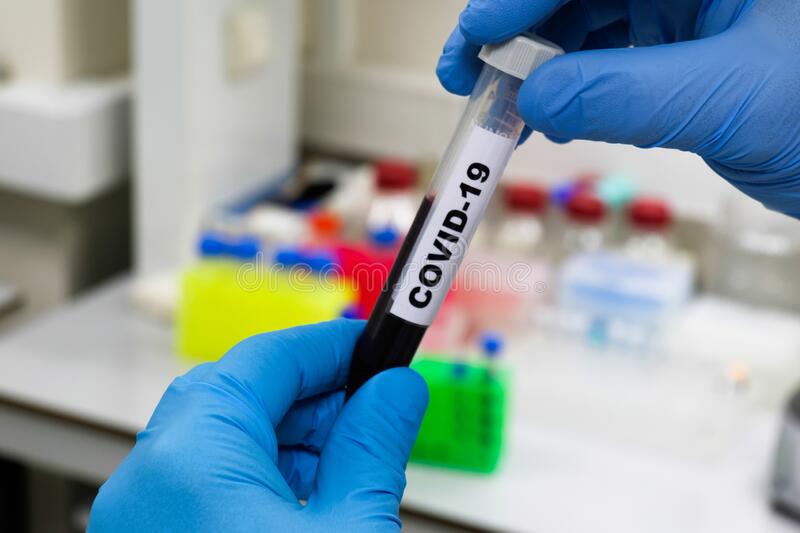 Exame confirma segundo óbito por covid-19 em Canudos