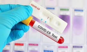 Boletim divulgado nesta quarta registra 21 novos casos de Covid-19 em Cícero Dantas